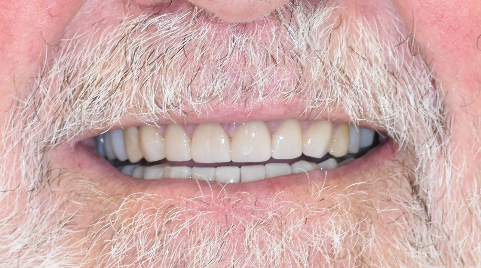 Réhabilitation globale après