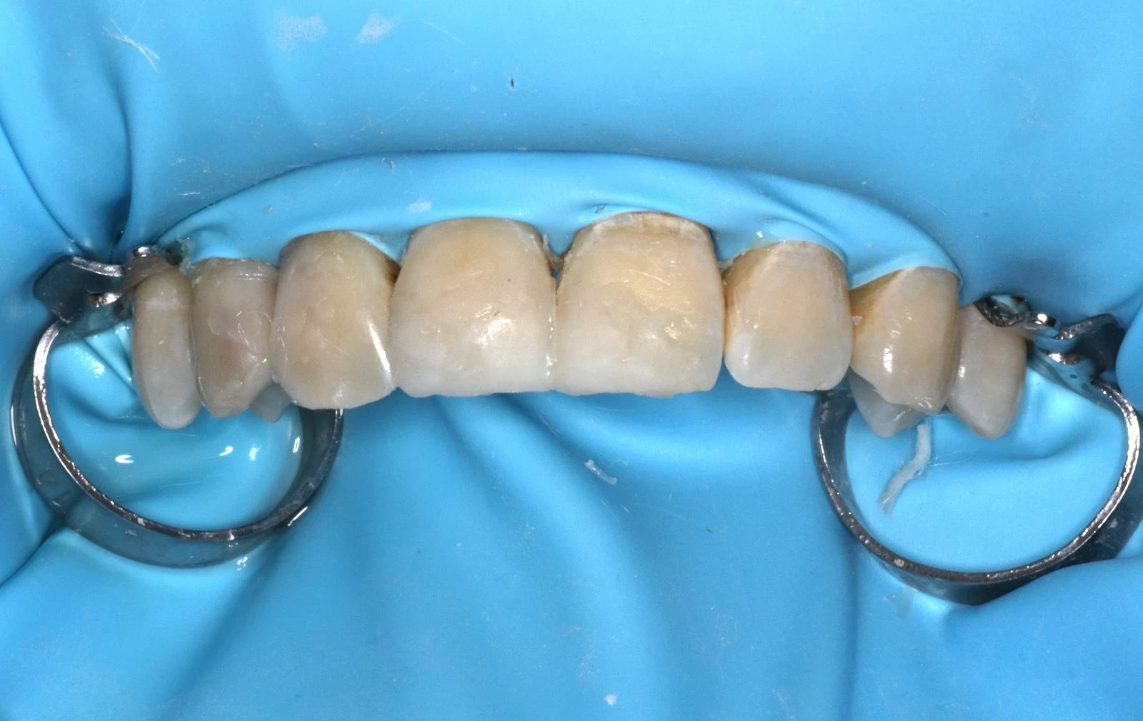 Composition esthétique pendant