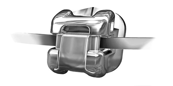 Orthodontie linguale au cabinet dentaire de Seilh