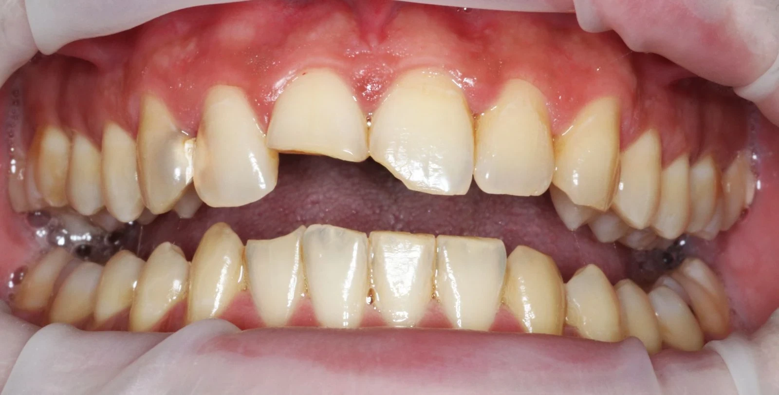 Composition esthétique avant