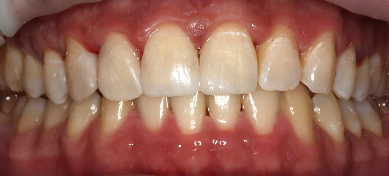 Composition esthétique après